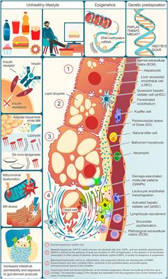 Inflammation and Fibrogenesis in MAFLD: Role of the Hepatic Immune System